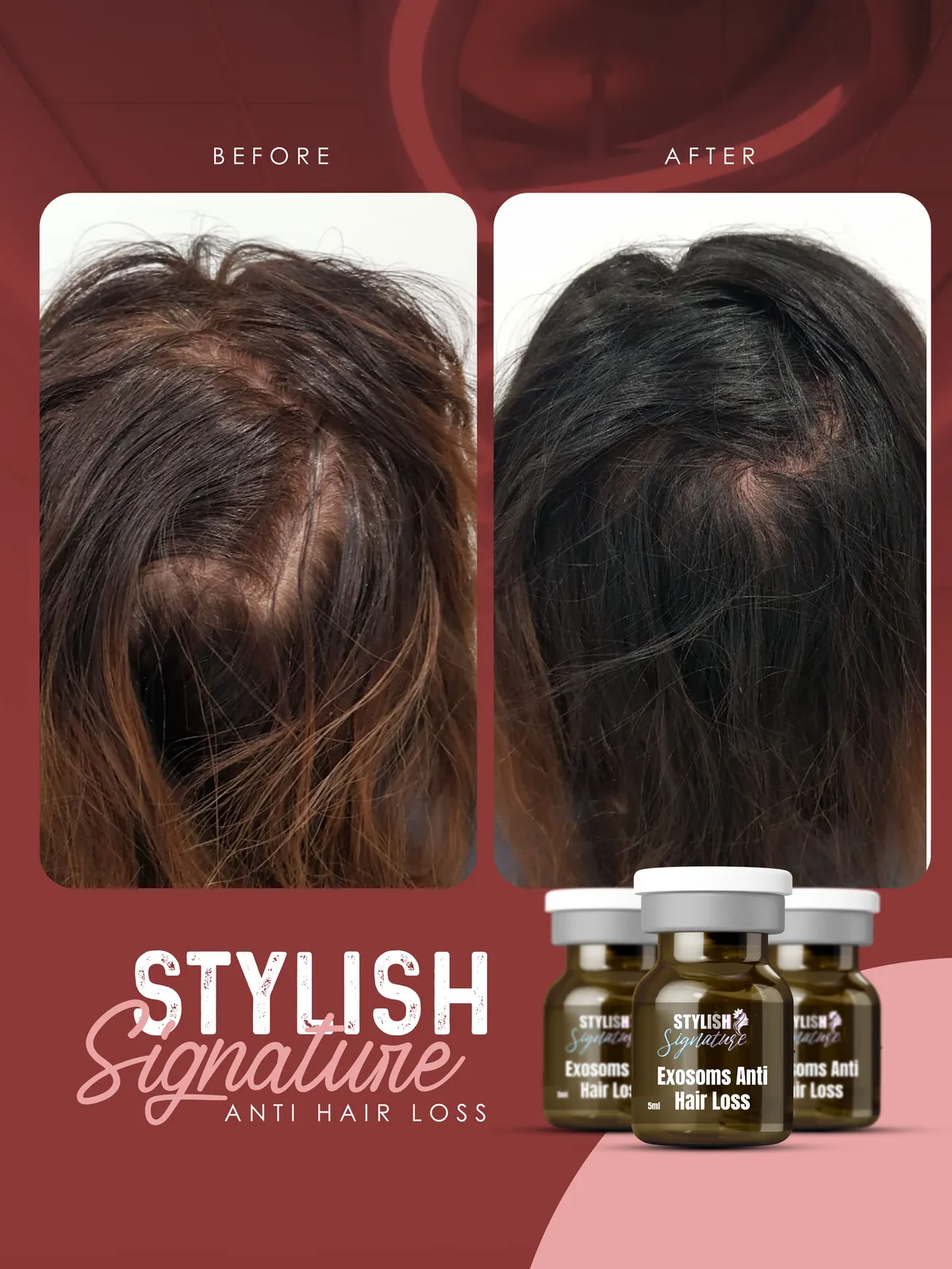 Exosoms Hair results 1