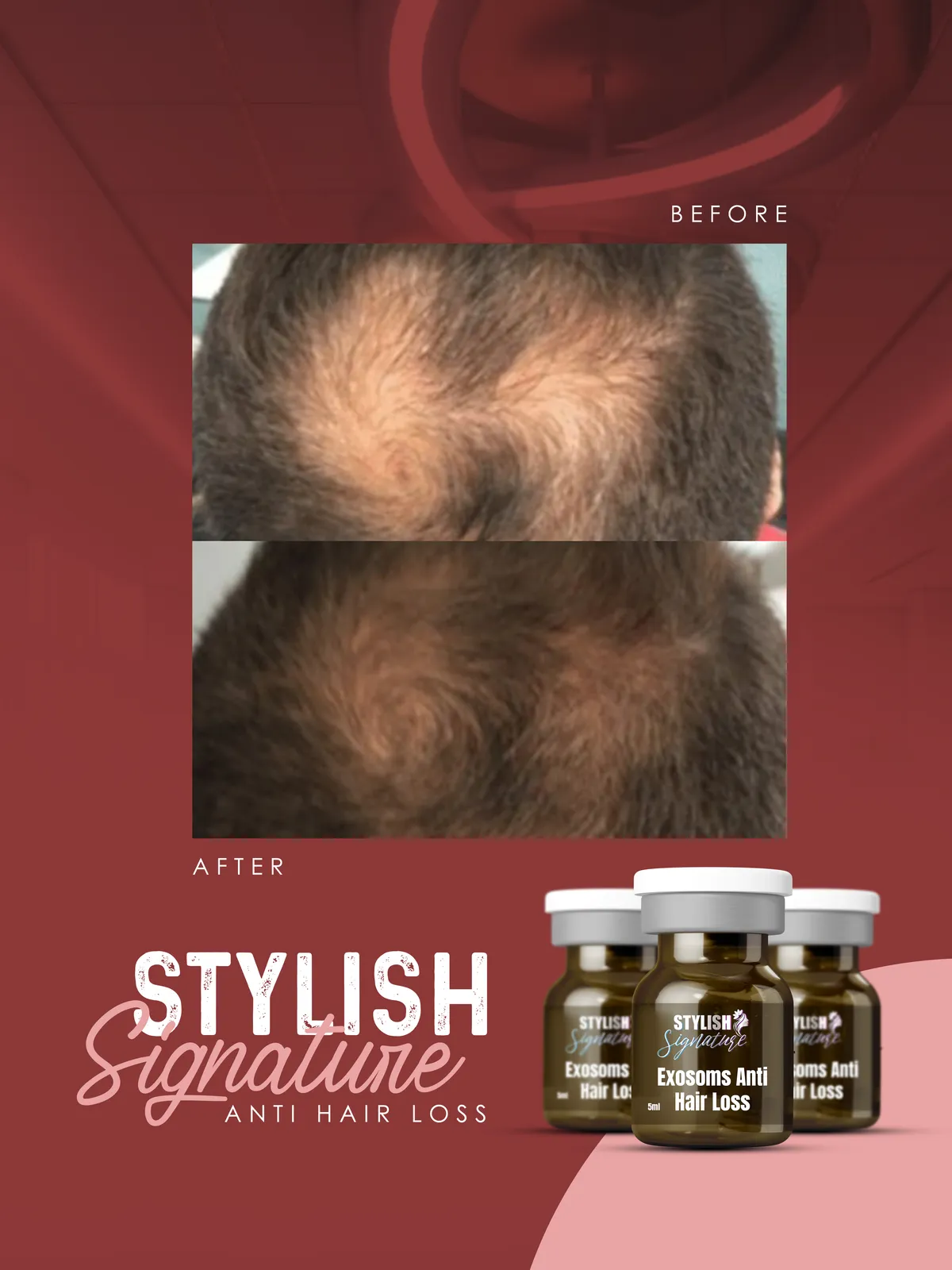 Exosoms Hair results 2