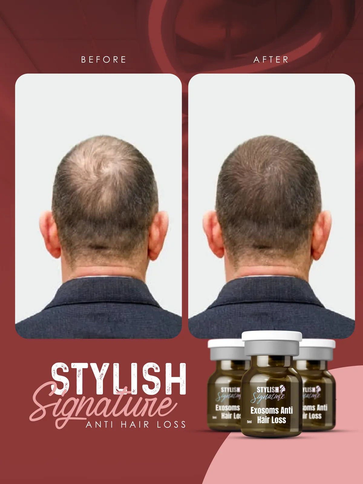 Exosoms Hair results 3