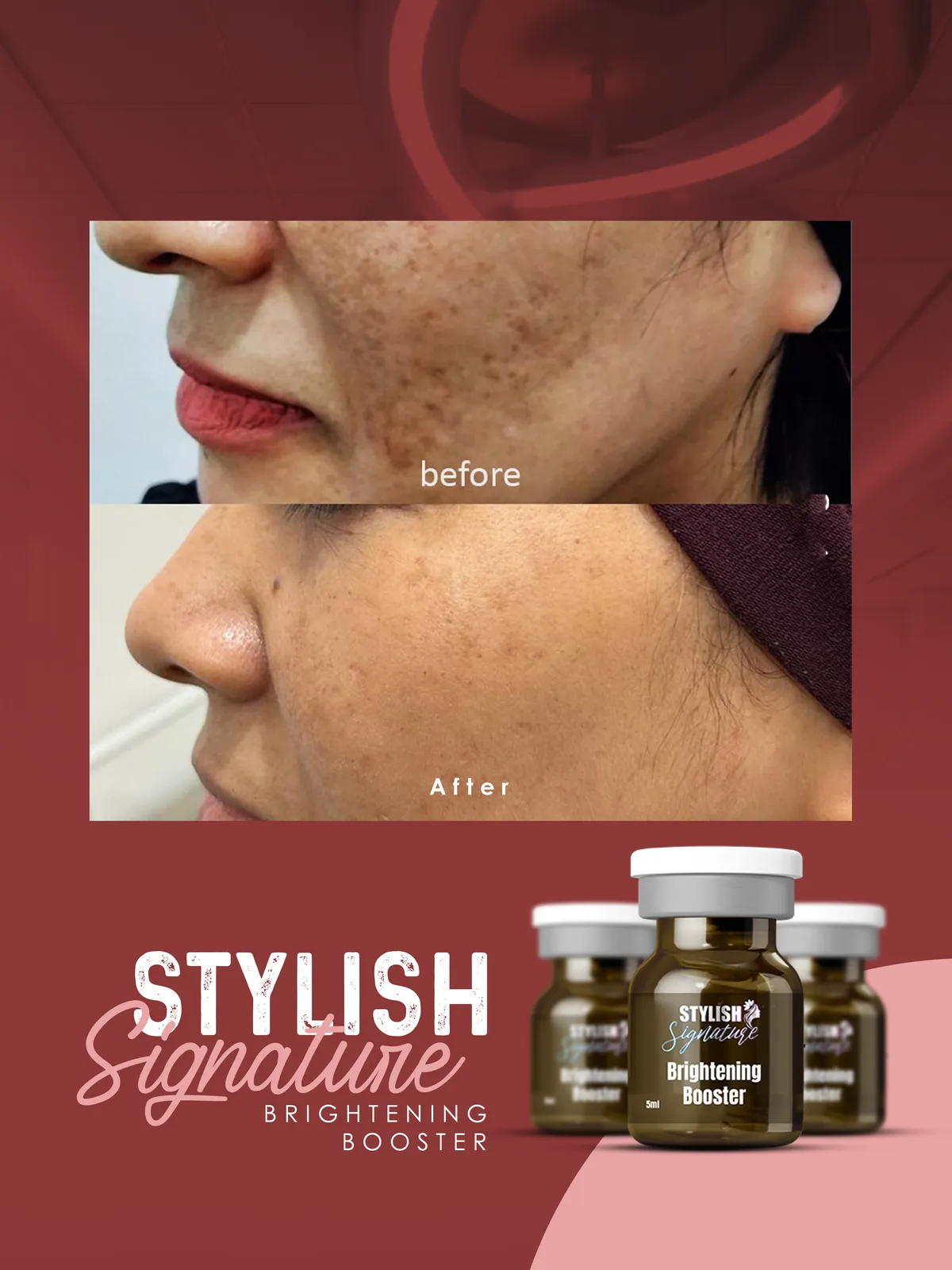 Brightning Booster results 2