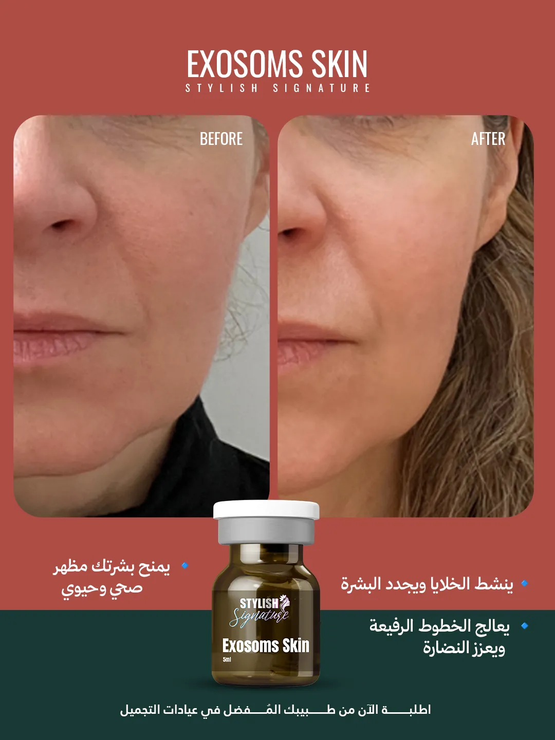 Exosoms Skin results 1