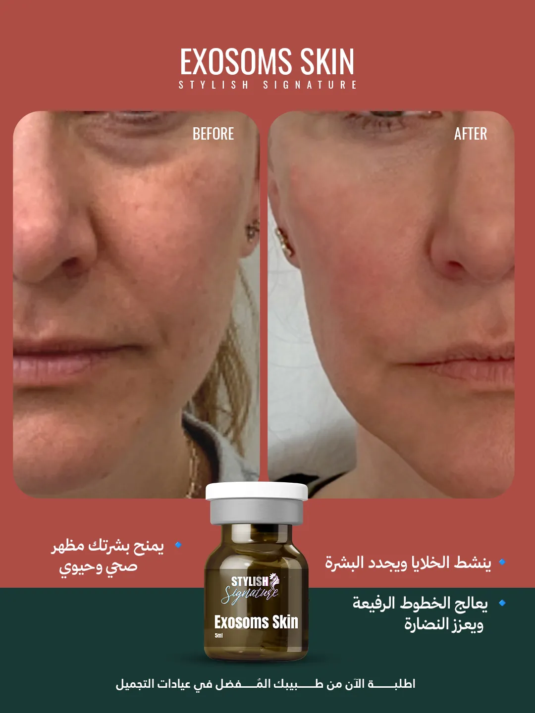 Exosoms Skin results 2