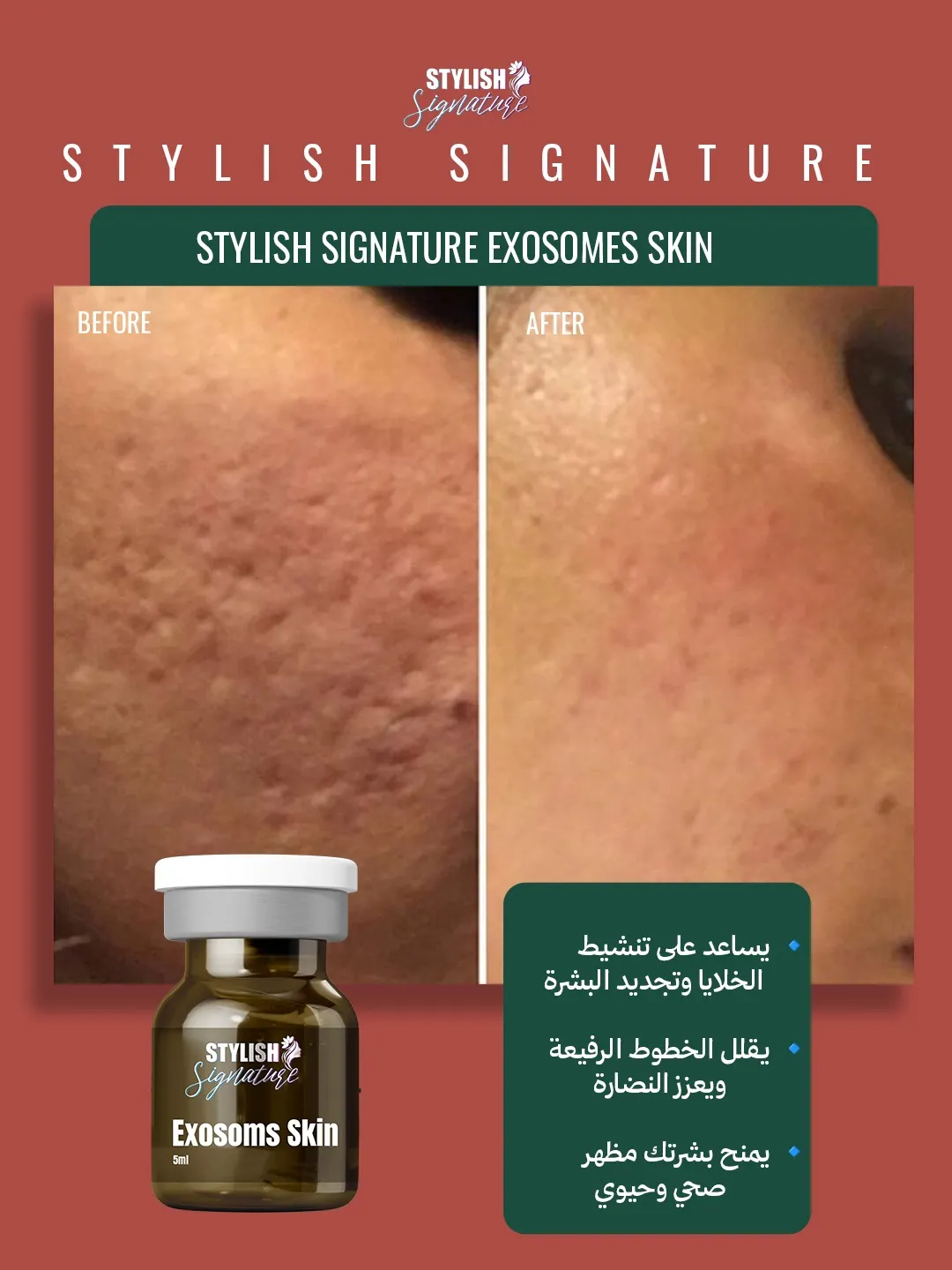 Exosoms Skin results 4