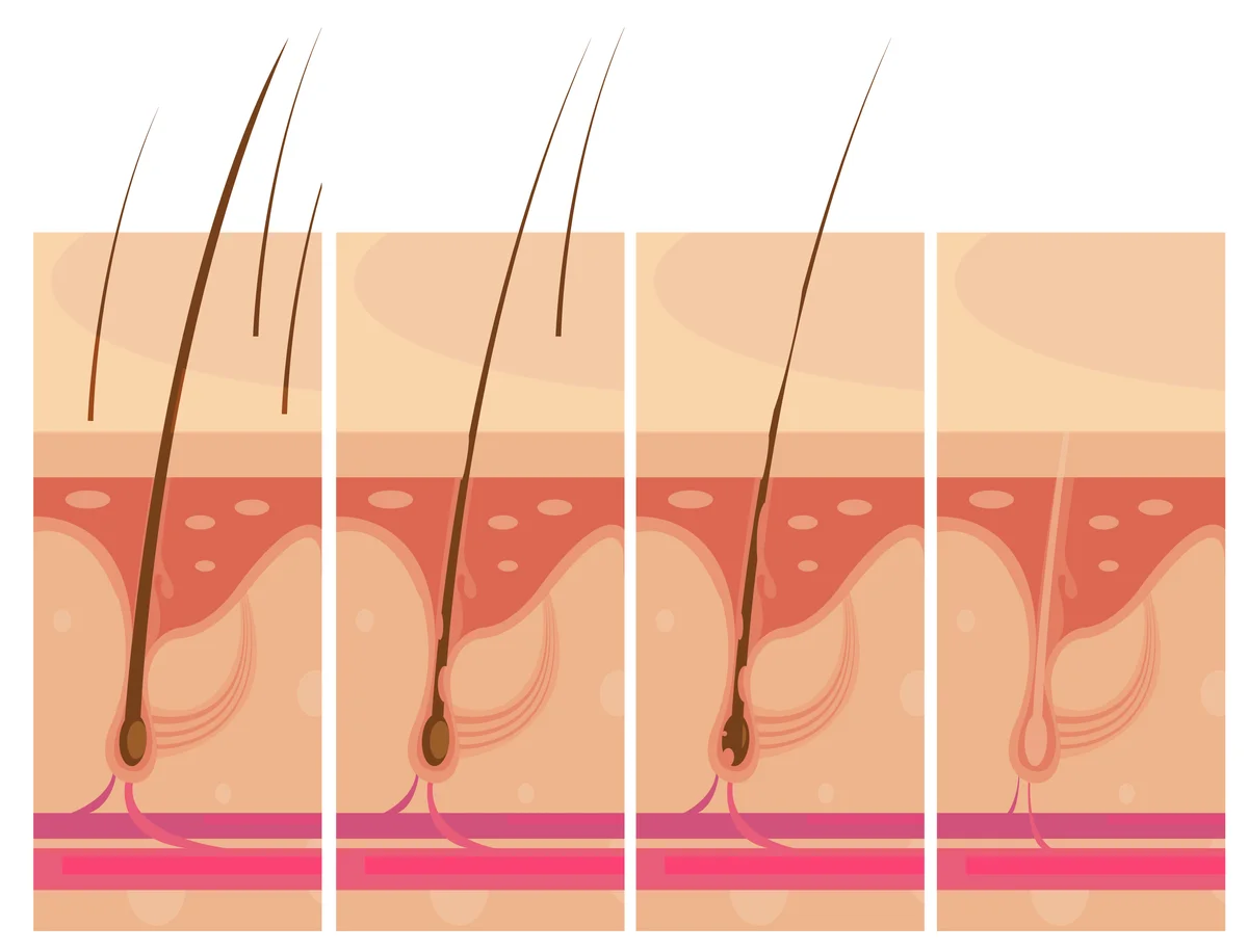 The Role of Exosomes in Treating Hair Loss: A Dermatologist's Guide